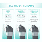 ERGO Bunion Corrector